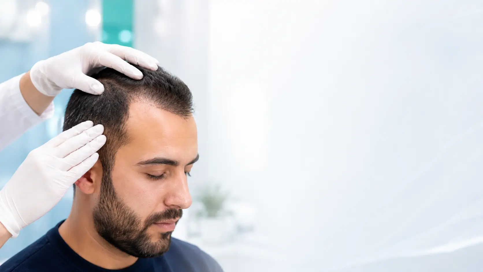 مراقبت‌های بعد از کاشت مو و بررسی خط رویش مو توسط پزشک در کلینیک نوژا کاشت