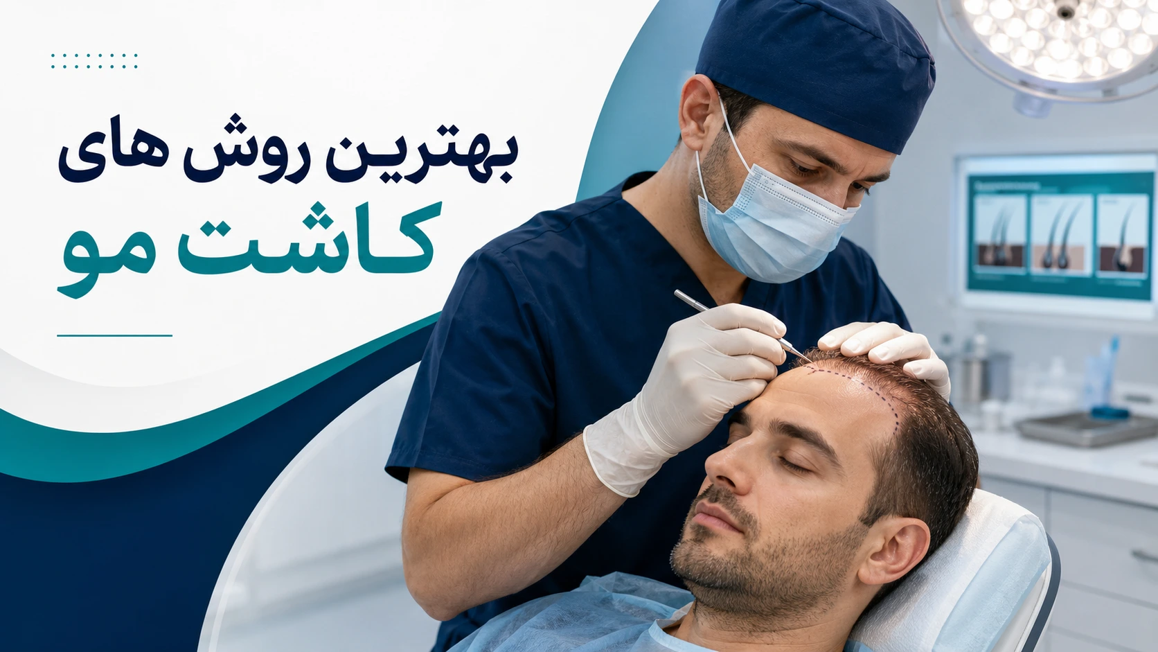 بهترین روش های کاشت مو
